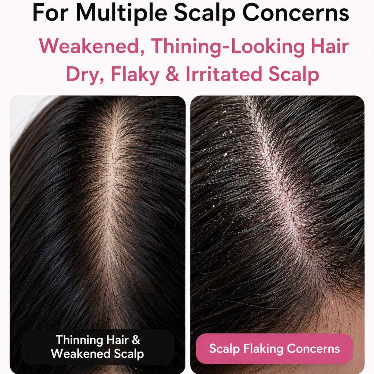 Medicube Rosemary PDRN Scalp Refresh & Nourish Serum