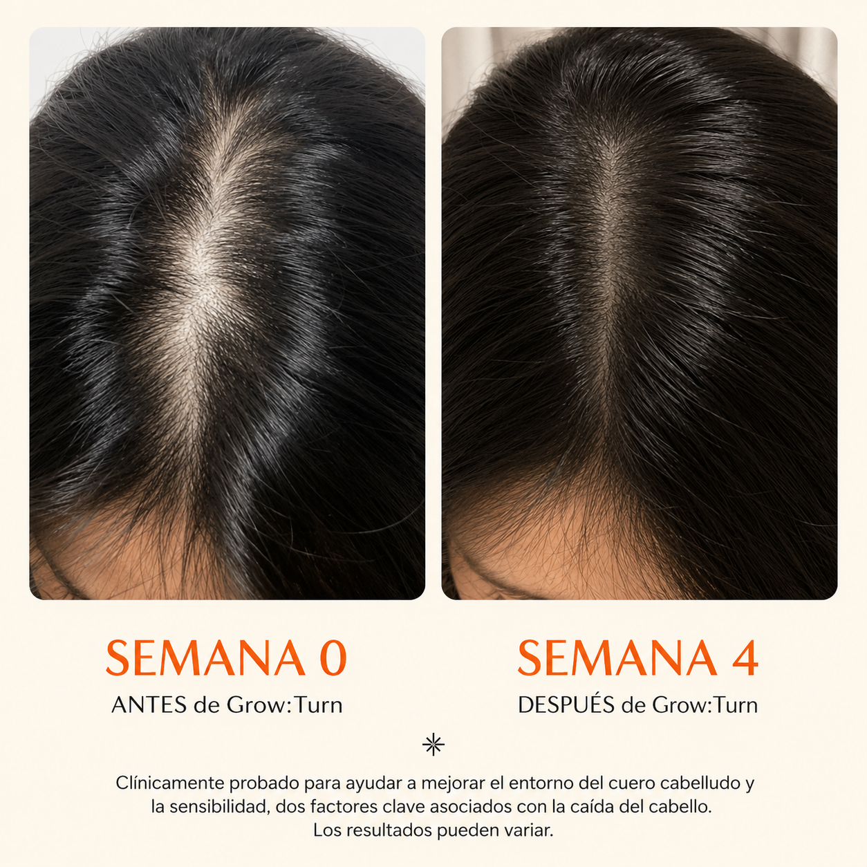 Lilyeve™ Grow Turn Complete Hair System - Sérum + Cepillo LED para potenciar tu rutina capilar diaria.