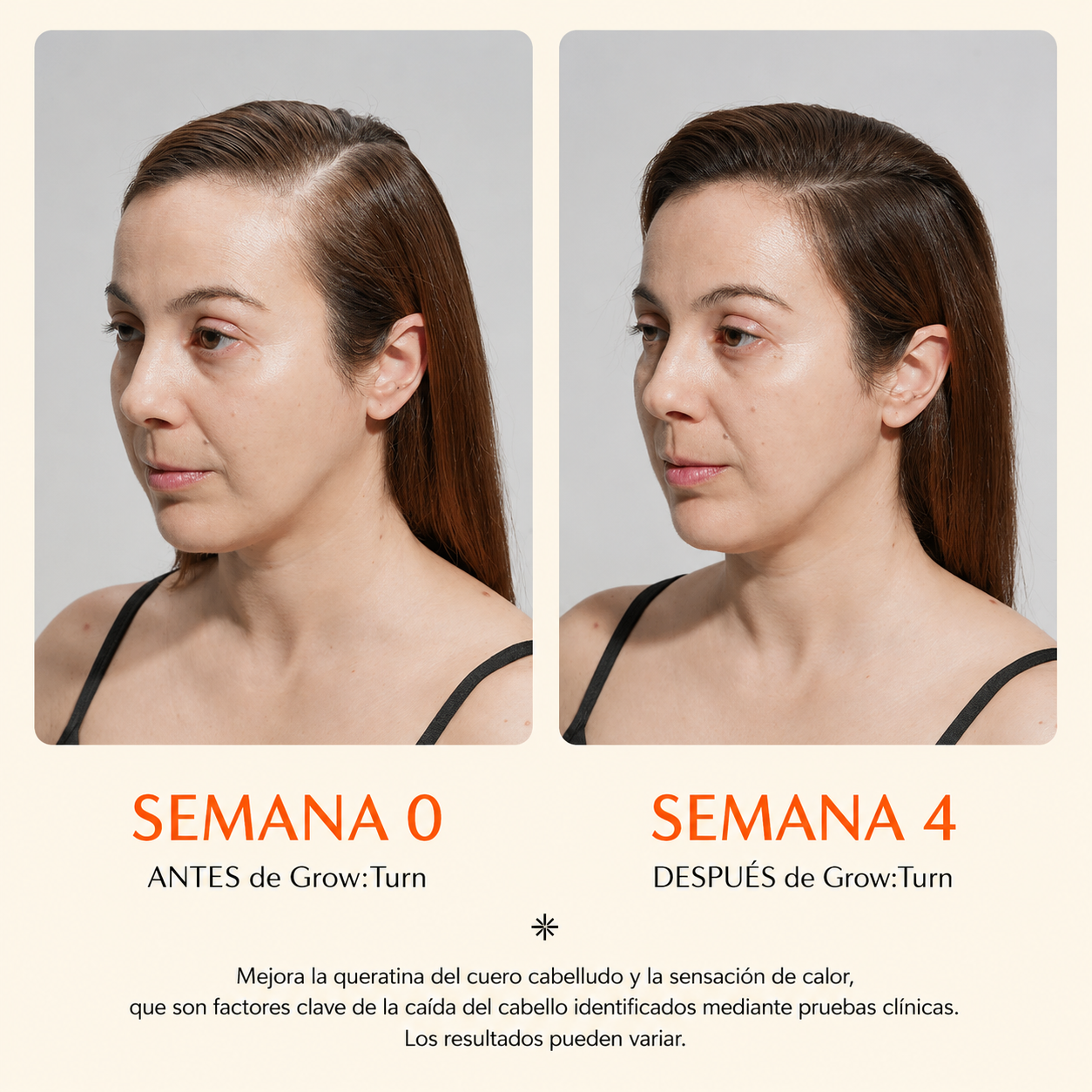 Lilyeve™ Grow Turn Complete Hair System - Sérum + Cepillo LED para potenciar tu rutina capilar diaria.